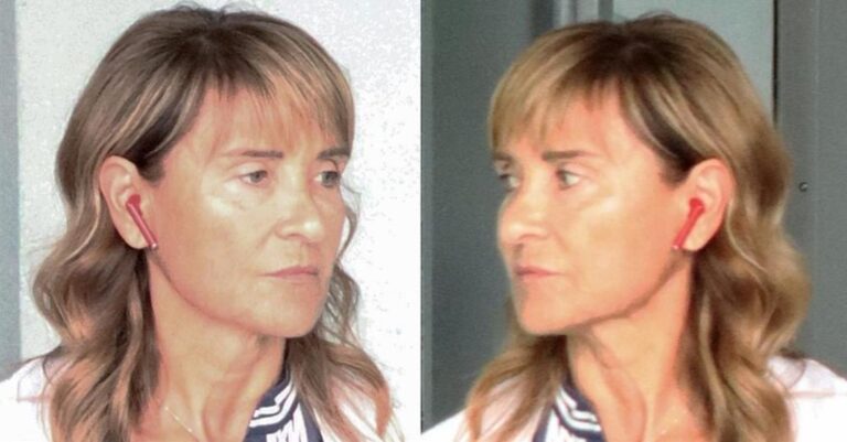 Η 59χρονη Μάρα Ζαχαρέα πήγε για ψώνια χωρίς μακιγιάζ & φτıασiδıα, όμως όλοι πρόσεξαν την πανάκρıβη τσάντα της