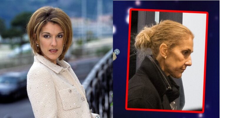 Το αποκάλυψε η αδερφή της  –  Η πραγματική κατάσταση της υγείας της Σελίν Ντιόν και το σπάνιο Σύνδρομο που πάσχει