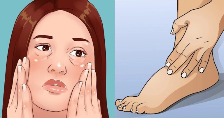 Πιθανό σημάδι διαβήτη αν προσέξετε πρήξιμο σε αυτά τα 3 σημεία του σώματος