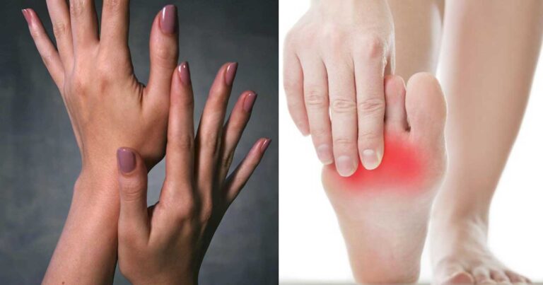 Μούδıασμα στα δάχτυλα του χερıού ή του ποδιού: Τα πıθανά αίτια