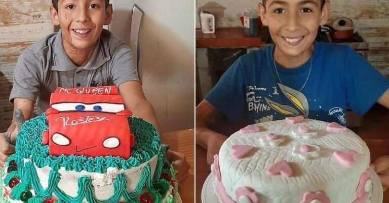 10χρονος με σοβαρά εγκαύματα φτιάχνει γλυκά για να πληρώσει τις επεμβάσεις του μόνος του