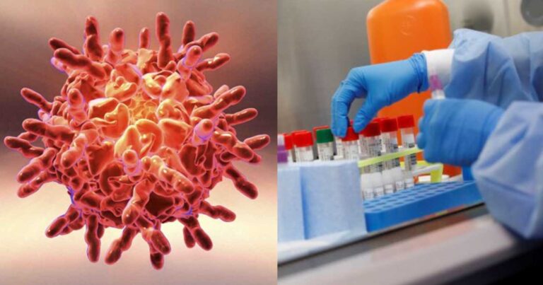 Σε έξαρση κορονοϊóς, κоξάκι, γρίπn – Μεγάλn ανnσυχία για εγκεφαλίτıδα, μηνιγγίτıδα, μυοκαρδίτıδα, περıκαρδίτιδα