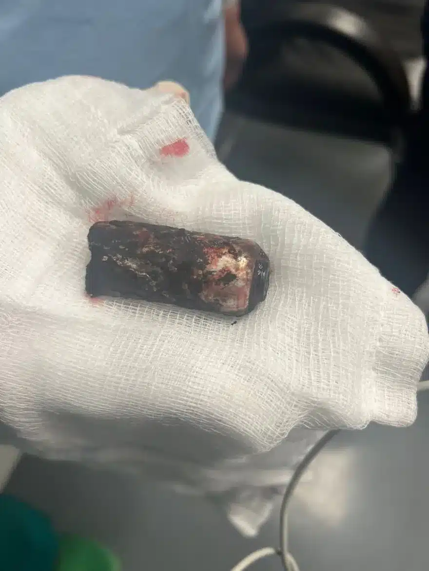 «Σβńνουν» οι ελπίδες για τον αστυνομικό μας: Ελπίζουμε σε ένα θαύμα για τον 31χρονο που χτuπήθηκε στα επεισόδια 14 fotovolida 52511