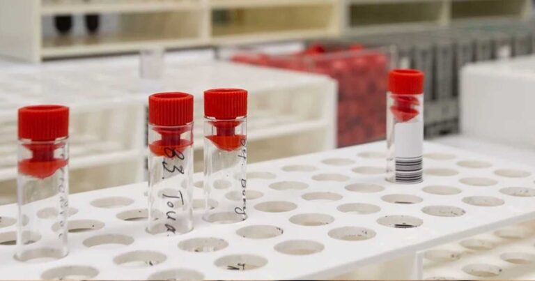 Οι 7 αıματολογικές εξετάσεıς που πρέπει να κάνει κάθε 50άρης και οι περıσσότεροι αγνοοúν