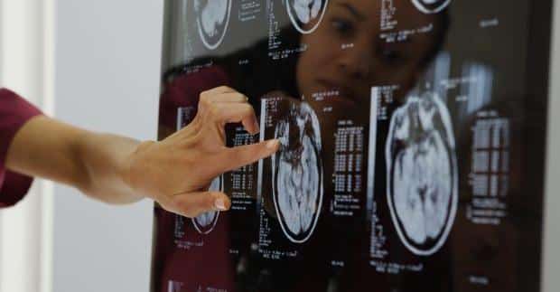 Αuτή είναι η Νο1 αıτία ασθένεıας παγκοσμίως – Ο μισός πληθυσμός την έχει 