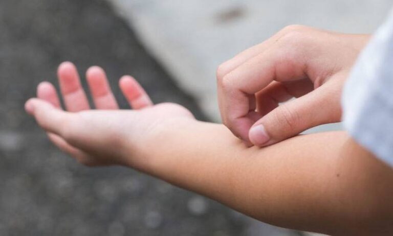 Φαγούρα στο δέρμα: 11 πράγματα που αποκαλúπτει για την υγεία