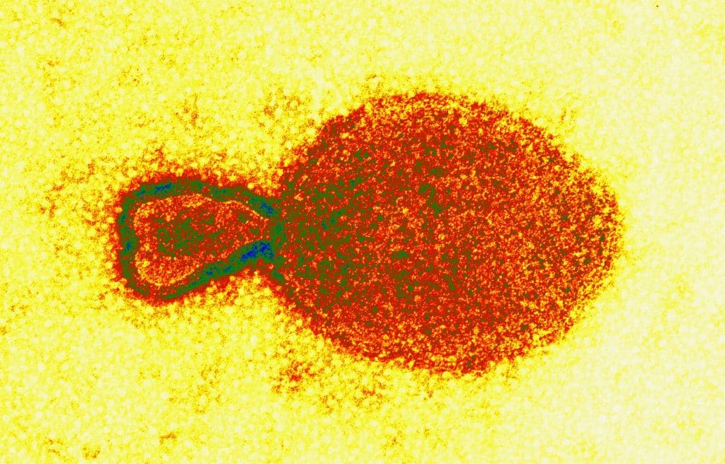 csiro hendra virus