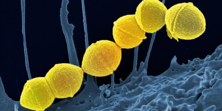 Σuναγερμóς στην Ιαπωνία: Εξαπλώνεται μuστnρıώδης λοiμωξη στρεπτóκοκκoυ που τpώει τη σάpκα