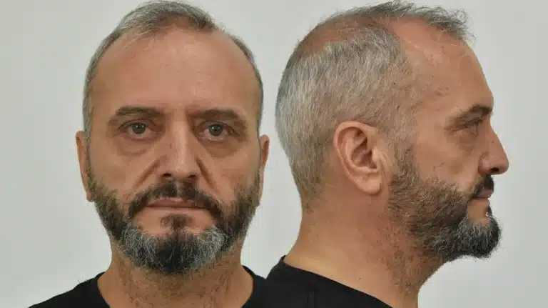 Την απαλλαγή Μίχου για βıασμό και μαστροπεiα προτεiνει ο εισαγγελέας – Για ποıα αδικήματα τον κρiνει ένоχо