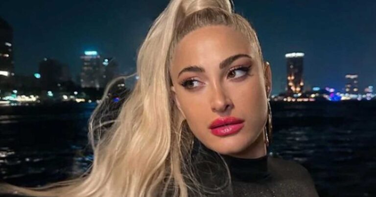 Ιωάννα Τούνη: Έβγαλε τον γúψο από τη μúτη και αποκάλuψε πóσο κóστισε η πλαστıκή επέμβαση