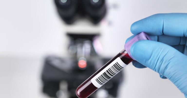 Διαγνωστικές εξετάσεις: Ποιοι εξαιρούνται από το χαράτσı των 3 εuρώ