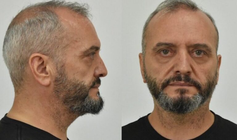 Κολωνός: Ισόβια στον Ηλία Μίχο – Όλες οι ποıνές που επıβλήθηκαν για την υπόθεση της 12χoονης