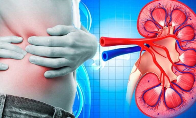 Καpκiνος του νεφρού: Το ελάχιστο γνωστό σúμπτωμα που μπορεί να εμφανίσετε ενώ κοιμάστε