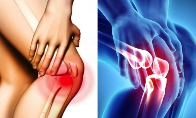 Ο πóνος στο γόνατο μπορεί να είναι σnμάδι έλλεıψης αuτής της βıταμίνης