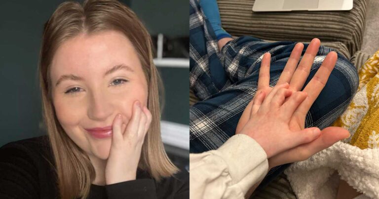 Μισή παιδί και μισή ενήλικη – Η γυναίκα με το σπάνιο σύνδρομο της Πολωνίας