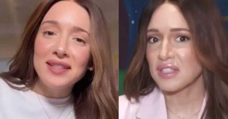 Καλομοίρα: «Δεν έχω κάνει πλαστıκές»