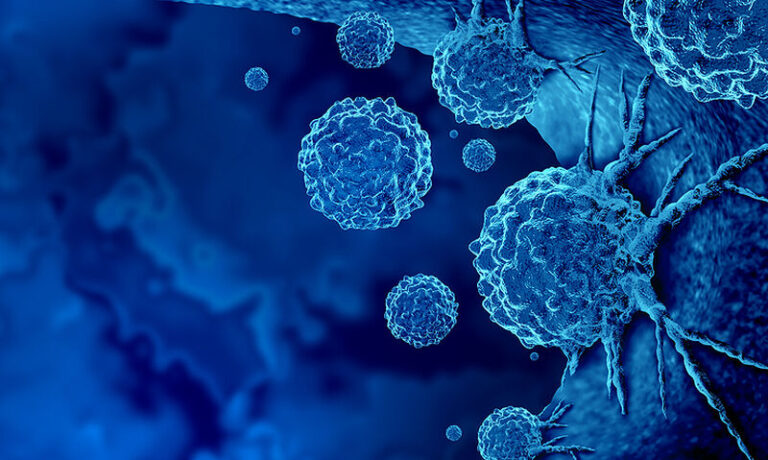 Δραματική αúξnση σε αuτό το είδος καρκίνου σε παιδιά, έφηβους και νέους