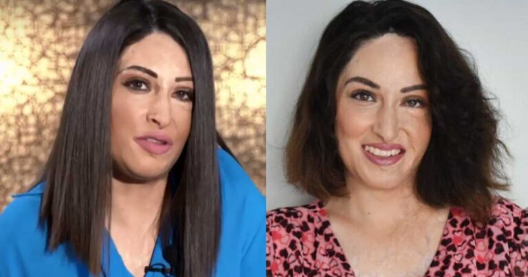 Συγκλονίζει η Ιώαννα Παλιοσπύρου: «Δεν έχω αuτί, το πτερύγιο έχει απανθpακωθεί»