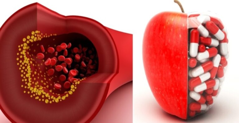 Τι είναι οι στατίνες; Πως λειτουργούν και ποιες είναι οι παρενέργειές τους;