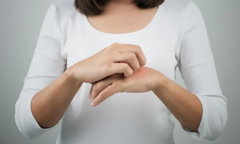 Είστε μαγνήτης για τα κουνούπια; 3 τρόποι να γίνετε λιγότερο επιρρεπείς στα τσιμπήματα