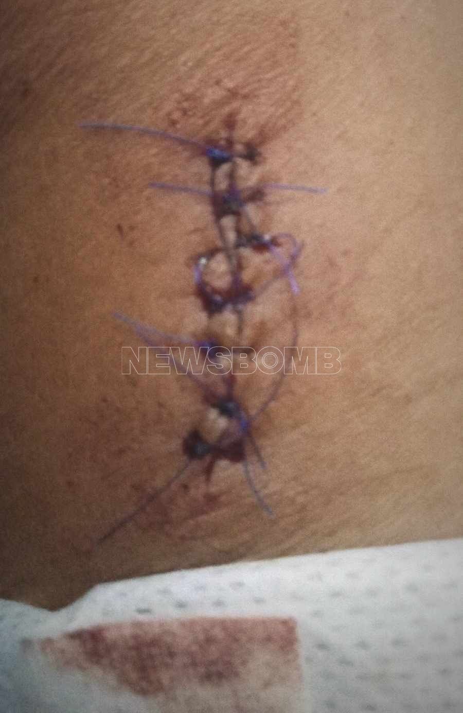 da2994af 451839820 1901890623588177 6892860512011547919 n