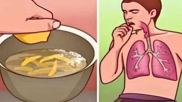 Αρχαία συνταγή αφαιρεί το φλέγμα από τους πνεύμονες και δεν την ξέρει κανείς – Κατάλληλη και για παιδιά
