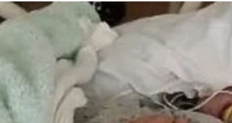 56χρονη μητέρα πήγε στο νοσοκομείο γεμάτη σπυράκια στο σώμα αλλά ήταν αργά: Άφωνοι και οι γιατροί όταν κατάλαβαν από τι πέθανε