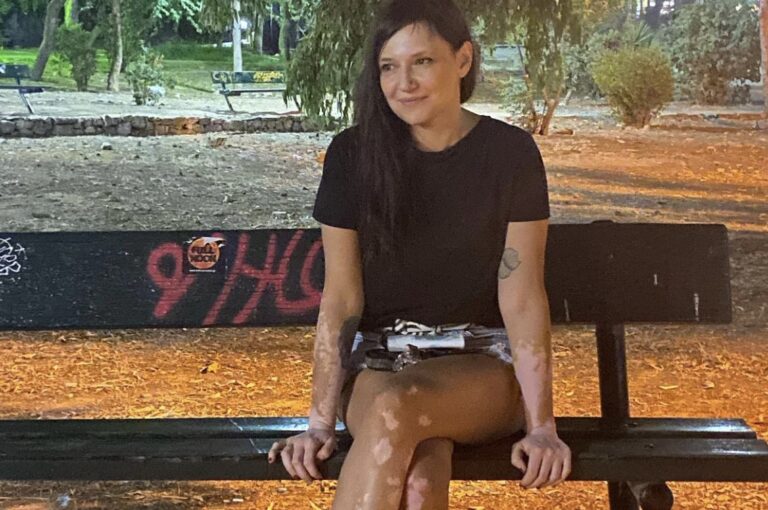 Φωτιά στην Αττική: Συγκλονίζουν οι φωτογραφίες της Αθηναΐδος Νέγκα μέσα από τις στάχτες