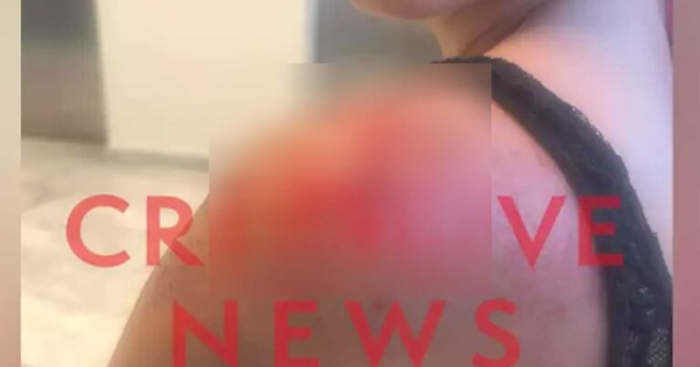 Εφιάλτης για 25χρονη – Την φωτογράφισε κρυφά, την χτύπησε με μηχανάκι και την έσυρε για 20 μέτρα