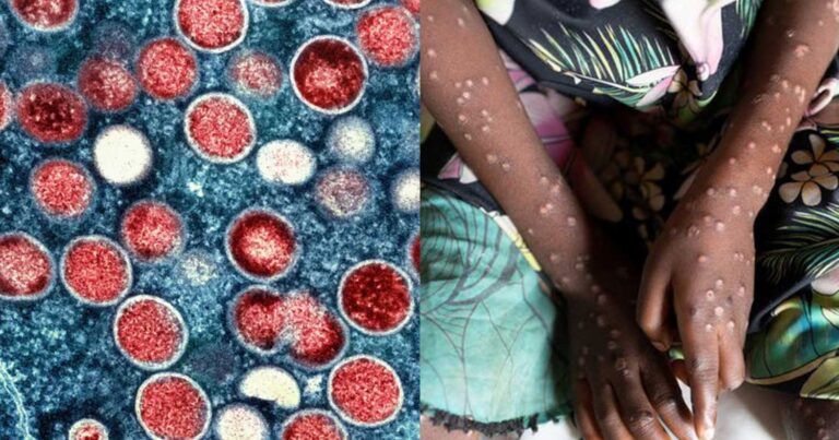 Συναγερμός για την νέα πανδημία –  Αρχίζουν οι εμβολιασμοί  στην Ελλάδα