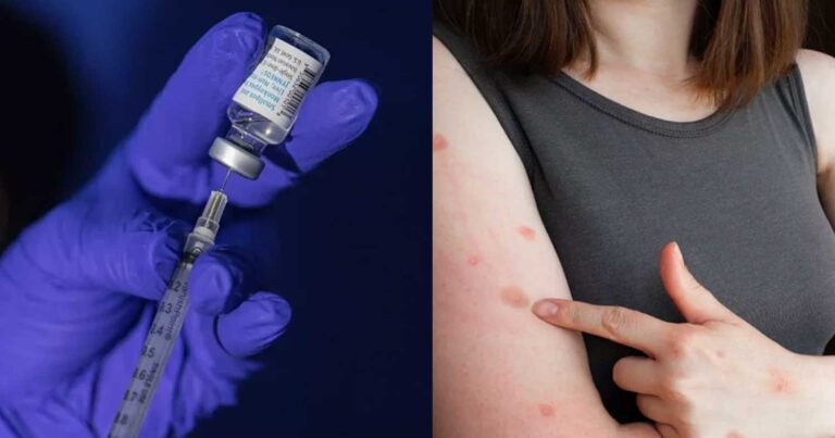 Ανοίγουν 5 εμβολιαστικά κέντρα σε όλη την Ελλάδα για την ευλογιά των πιθήκων