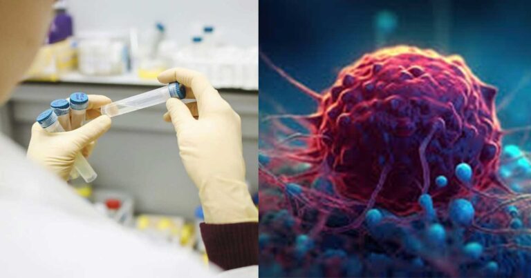 Άρχισαν σε 7 χώρες οι πρώτες στον κόσμο δοκιμές εμβολίου mRNA κατά του καρκίνου του πνεύμονα