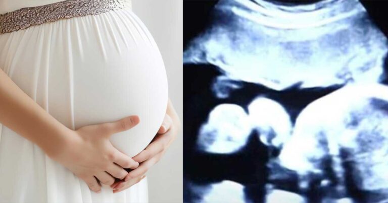 52χρονη είναι έγκuος στα δίδυμα παιδιά του γαμπρού της – Όταν όμως οι γιατροί είδαν τον τελευταίο υπέρηχο «πάγωσαν»