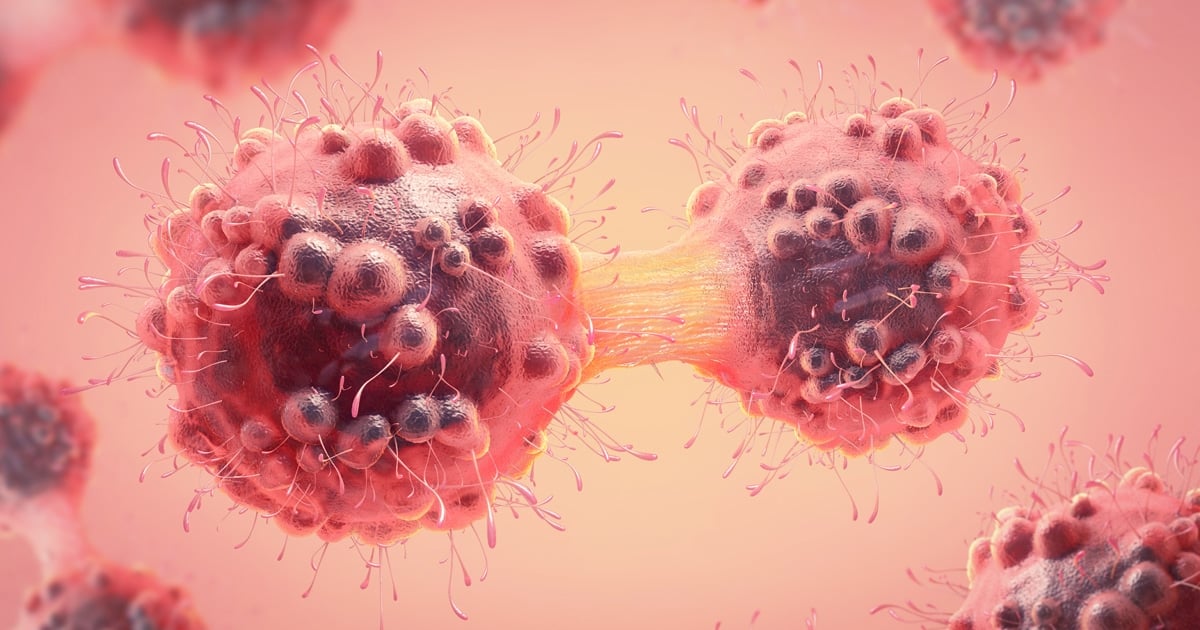 04 blog cancer cells l