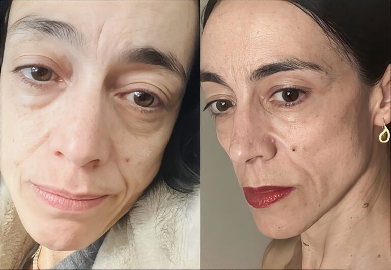 Έλενα Τοπαλίδου: Έσπασε τη σιωπή της για όσα ακούγονται για την εξωτερική της εμφάνιση και τον χωρισμό της από τον Νίκο Κουρή