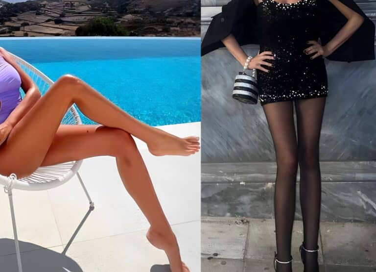 Έχει τα πιο μακριά πόδια στην Ελλάδα – Η διάσημη Ελληνίδα με ύψος 1,85 που δεν περνάει με τίποτα απαρατήρητη
