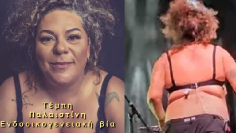 Έκλεισε στόματα η Ματούλα Ζαμάνη για όλο το σούσουρο με την μπλούζ: «15 μέρες μετά τη συναυλία, κιτρινίλα και γλίτσα…»