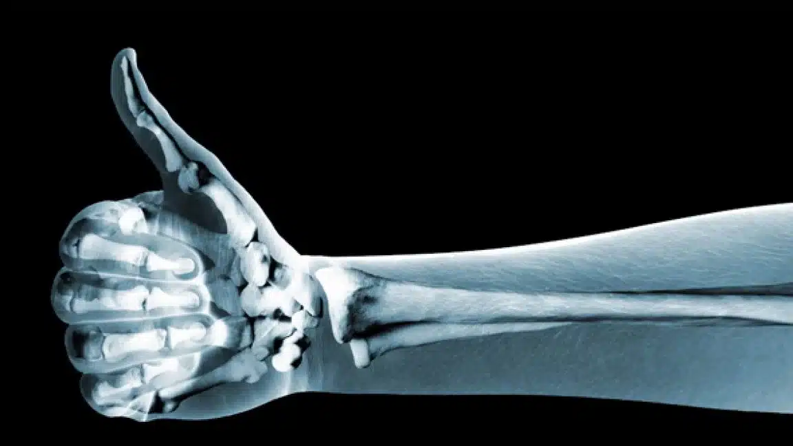 runner 20840 1152x648 1