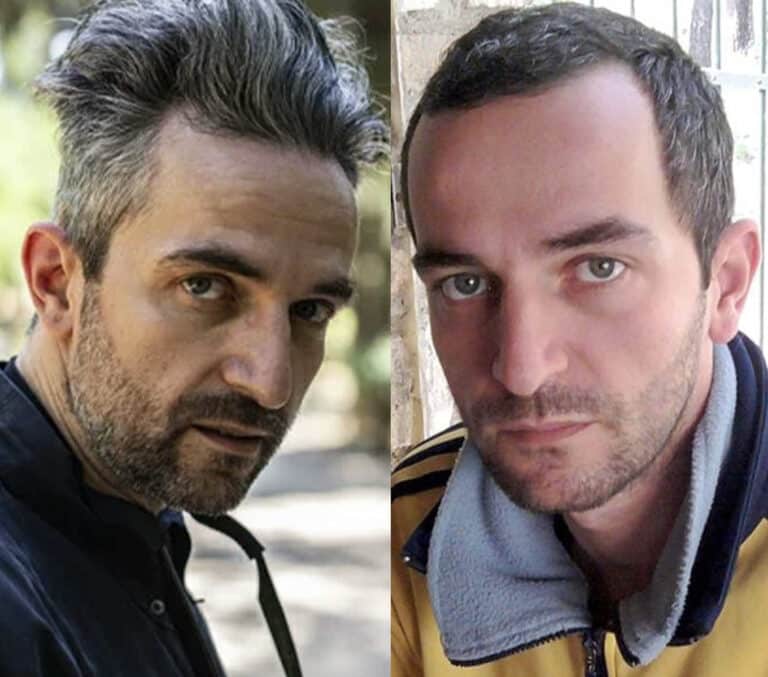 Άρης Σερβετάλης: Εμφανίστηκε με τεpάστιες φαβορίτες και μακρύ μαλλί στα πλάγια και πίσω και κοντό μπροστά στην ΕΡΤ