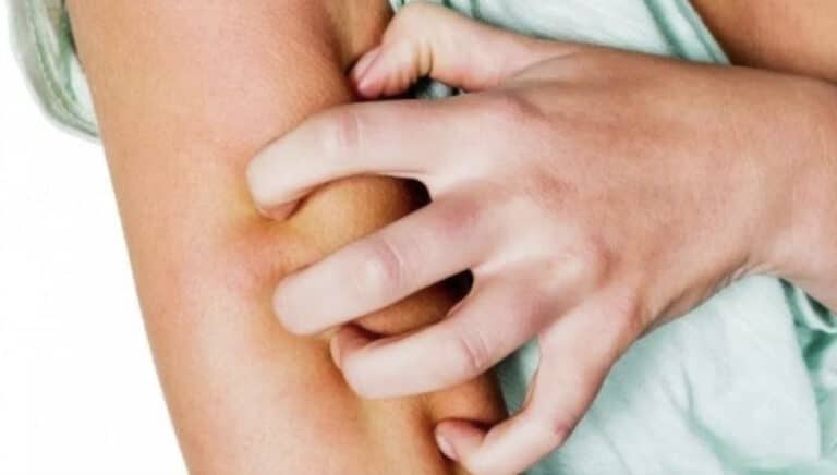Συναγερμός στα Χανιά – Εμφανίστηκε νορβηγική ψώρα