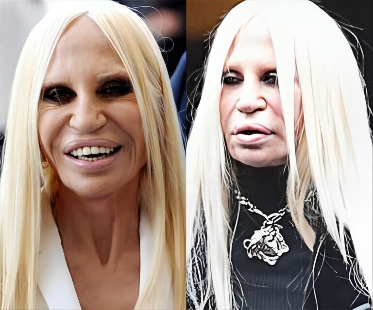 Μήπως είναι Photoshop; Σάλος με τη νέα εικόνα της Ντονατέλα Βερσάτσε – Δıαφήμıσε το καινούργιο της πρόσωπο & τα σχόλια… οpγıάζουν 