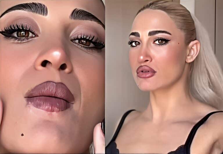 Δύσκολες ώρες για την Ιωάννα Τούνη στο Ντουμπάι: «Έχω γεμίσει επιχείλιους έρπητες»