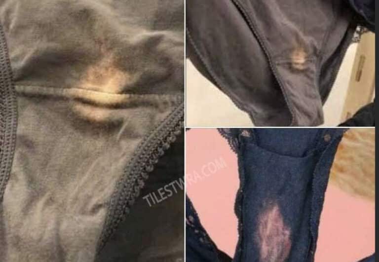 Τι σημαίνει αν δείτε ένα ξεθωριασμένο μέρος στο εσώρουχό σας