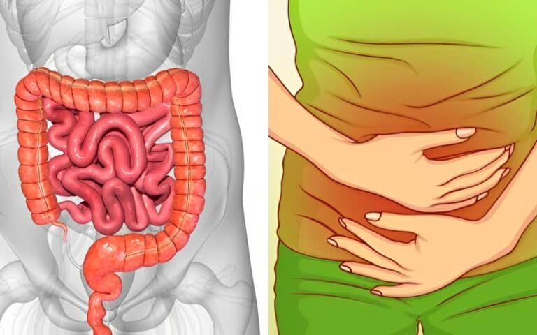Αέρια στο έντερο: Τι δείχνουν για την υγεία μας – Ποιες οι αιτίες και πως να αντιμετωπίσουμε το πρόβλημα
