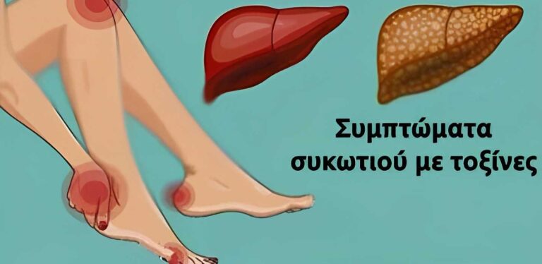 11 Σημάδια ότι το συκώτι σας δεν λειτουργεί σωστά και τοξίνες χτίζονται στο σώμα σας