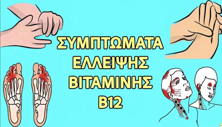 Αuτά είναι τα σημάδια έλλειψης βιταμίνης Β12, μια σιωπηλή απειλή που μπορεί να βλάψει τον εγκέφαλο σας