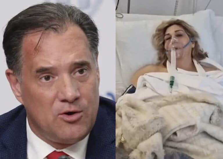 Άδωνις Γεωργιάδης για τη γιατρό στην Πάτρα: «Ψευδές ότι προερχόταν από 36ωρη εφημερία»