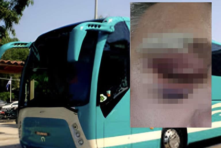 Άγρια επίθεση σε οδηγό ΚΤΕΛ – Τον χτύπησαν στο κεφάλι με κράνη γιατί τους ζήτησε να μετακινήσουν το μηχανάκι τους