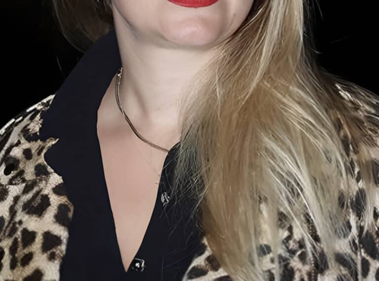 Άγνωστος οδηγός παρέσυρε πασίγνωστη Ελληνίδα ηθοποιό με το αυτοκίνητό του και την εγκατέλειψε