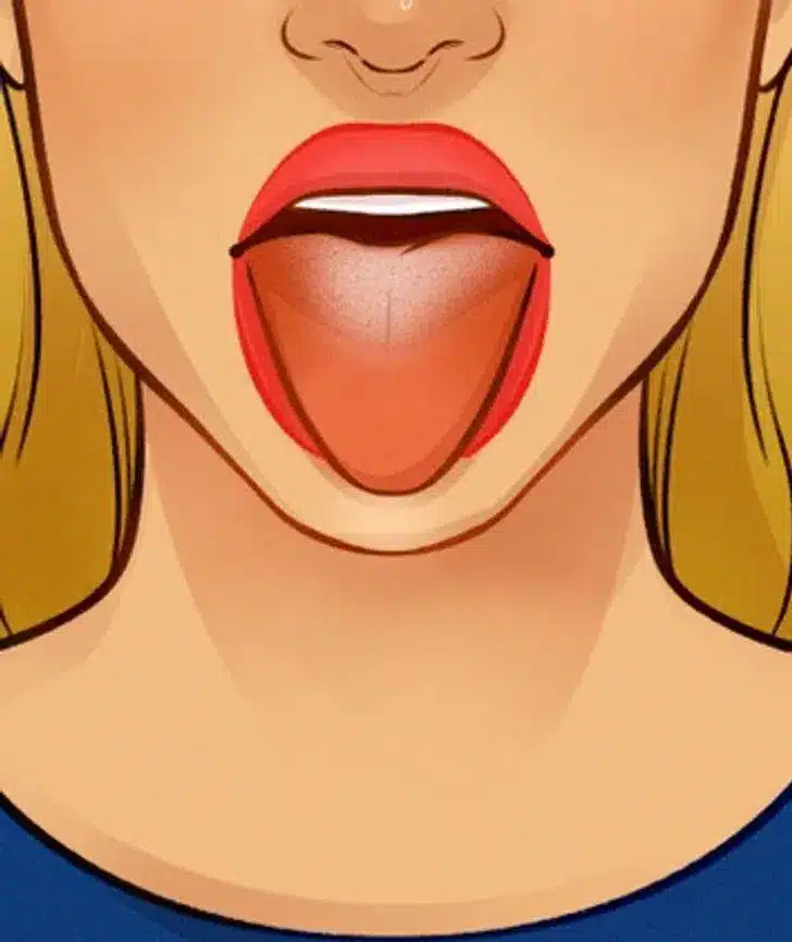 09.png